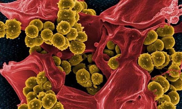Staphylococcus aureus là nguyên nhân gây viêm tuyến tiền liệt do vi khuẩn